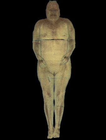 Visible Human Research